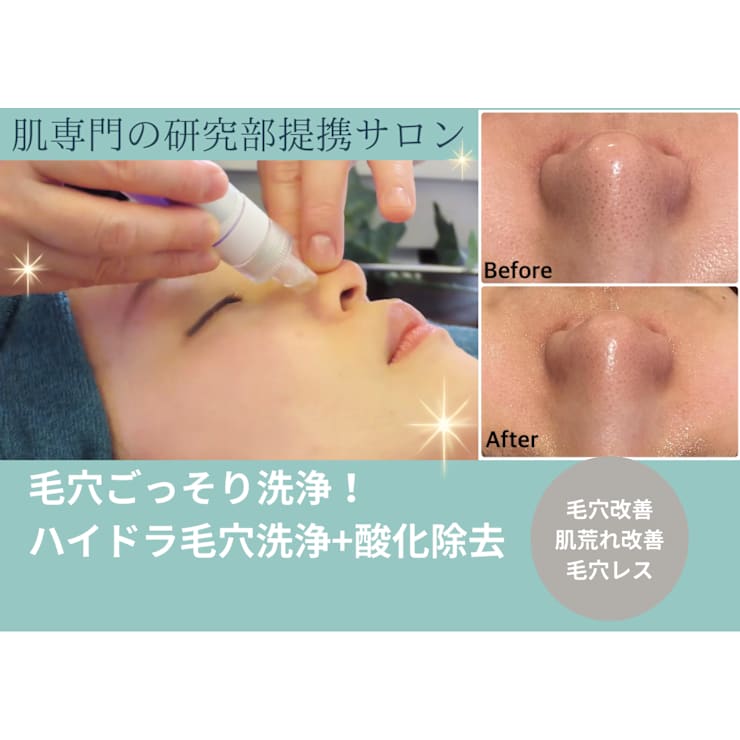 人気メニュー♪♪【毛穴ごっそり洗浄】ハイドラシャイン毛穴洗浄+極上