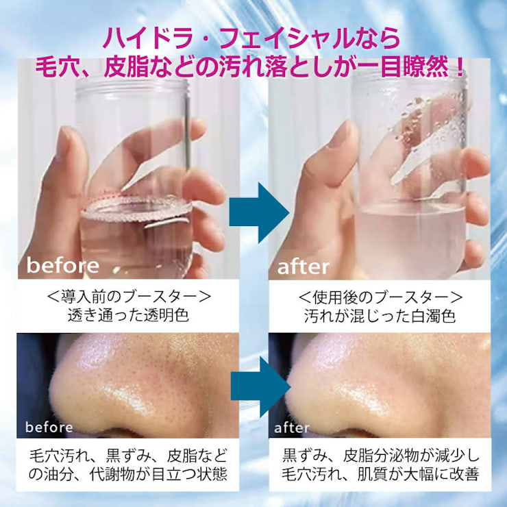 気になる毛穴を何とかしたい！毛穴、角質ケア人気No.1☆【ハイドラ