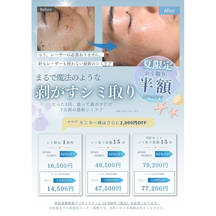 夏限定】剝がすシミ取り|半額~ | プリンセスエステティックサロン 夏限定】剝がすシミ取り|半額~ | プリンセスエステティックサロン
