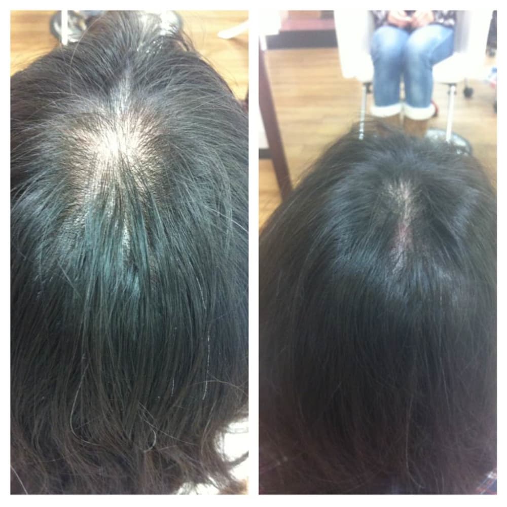 ヒト幹細胞培養液100 発毛促進スパで頭皮の育毛環境の改善を 円 123円 Freyahair Spa Totalbeautysalon フレイア ヘアアンドスパ トータルビューティサロン のこだわり特集 美容院 美容室を予約するなら楽天ビューティ