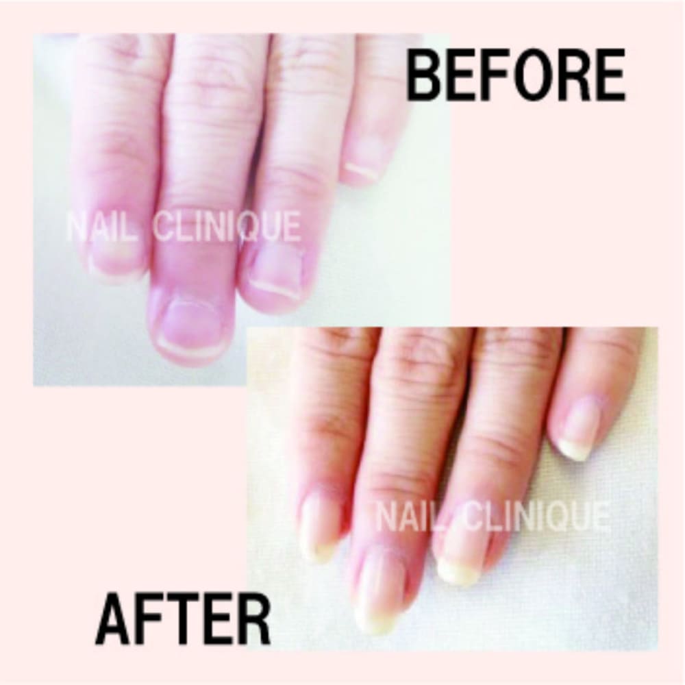 Nail Clinique クリニーク の予約 サロン情報 ネイル まつげサロン