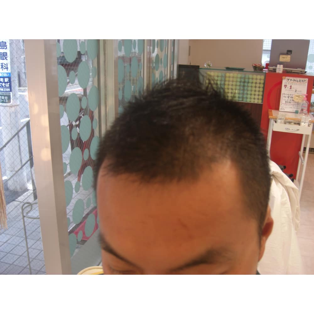 おしゃれ坊主 Link Hair Design リンクヘアーデザイン のヘアスタイル 美容院 美容室を予約するなら楽天ビューティ