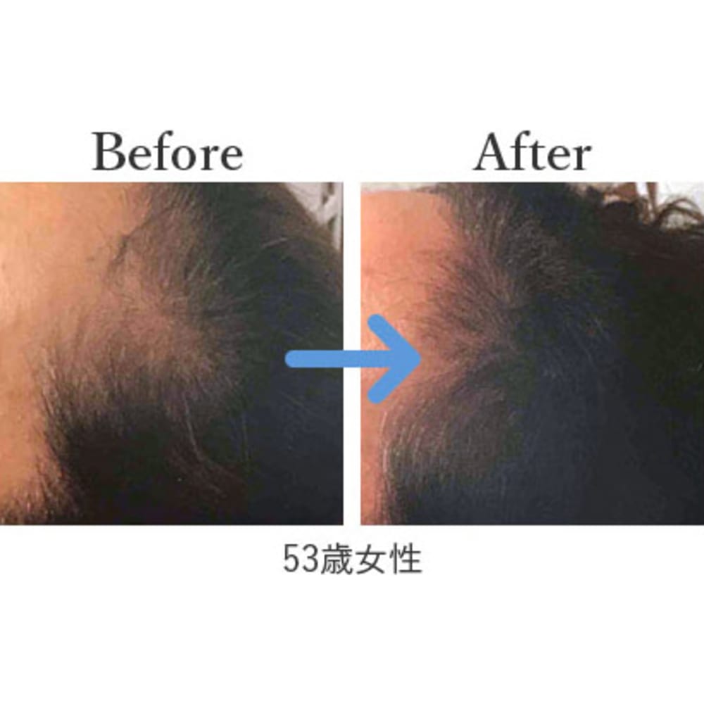 アクティバート 細胞レベルに働きかけ健やかで美しい髪に ヒト幹細胞培養液の有効成分で育毛 発毛 Coco Maison ココメゾン のこだわり特集 美容院 美容室を予約するなら楽天ビューティ アクティバート 細胞レベルに働きかけ健やかで美しい髪に ヒト幹細胞培養液の有効成分で育毛 発毛 Coco Maison ココメゾン のこだわり特集 美容院 美容室を予約するなら楽天ビューティ