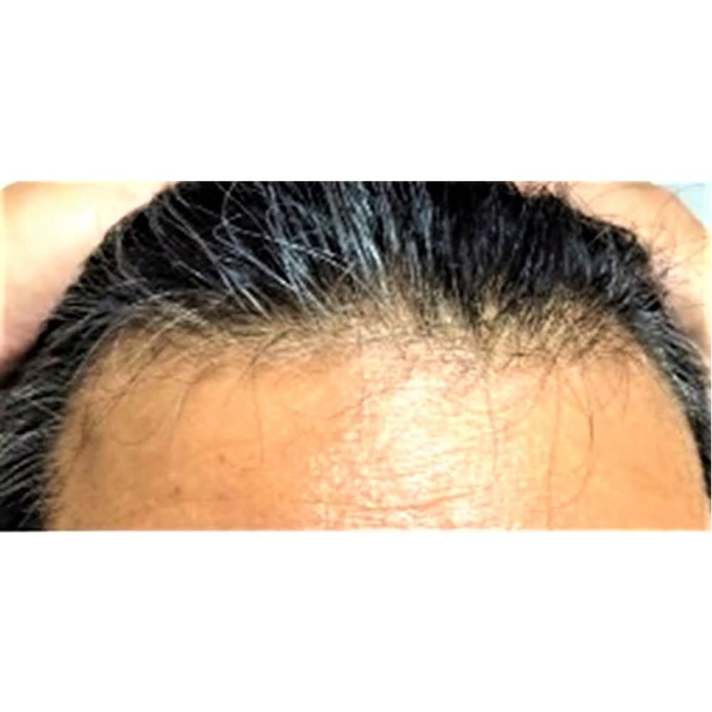 白髪でお悩みの方に 白髪外来 Rule Of Beauty Hair アムズ御所南サロン ルール のこだわり特集 美容院 美容室を予約するなら楽天ビューティ