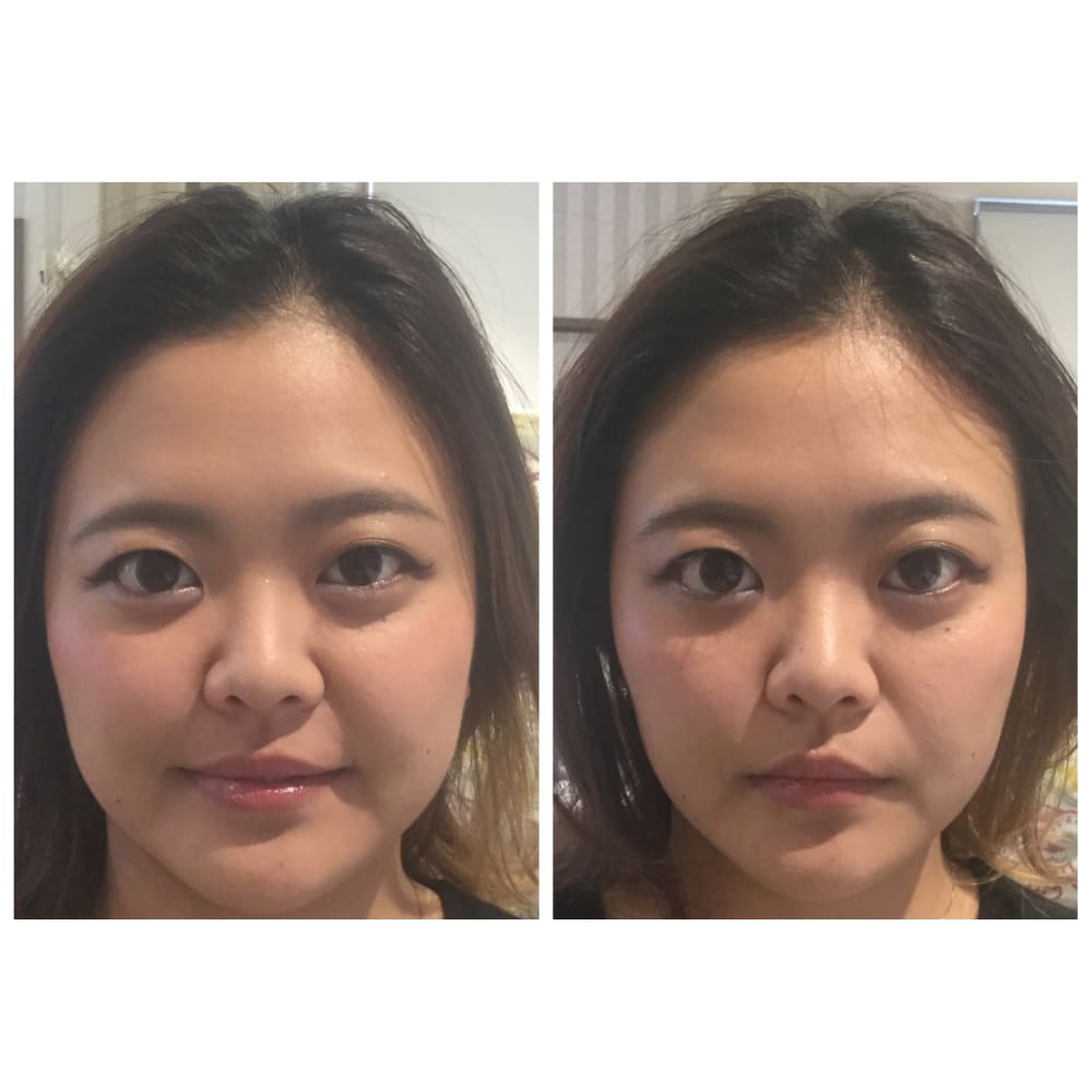 小顔ラボ 人気no 1メニュー 美顔 小顔メイキング 小顔ラボラトリーはるき 心斎橋店 コガオラボラトリーハルキシンサイバシテン のこだわり特集 エステサロンを予約するなら楽天ビューティ 小顔ラボ 人気no 1メニュー 美顔 小顔メイキング 小顔ラボラトリーはるき 心斎橋店 コガオラボラトリーハルキシンサイバシテン のこだわり特集 エステサロンを予約するなら楽天ビューティ