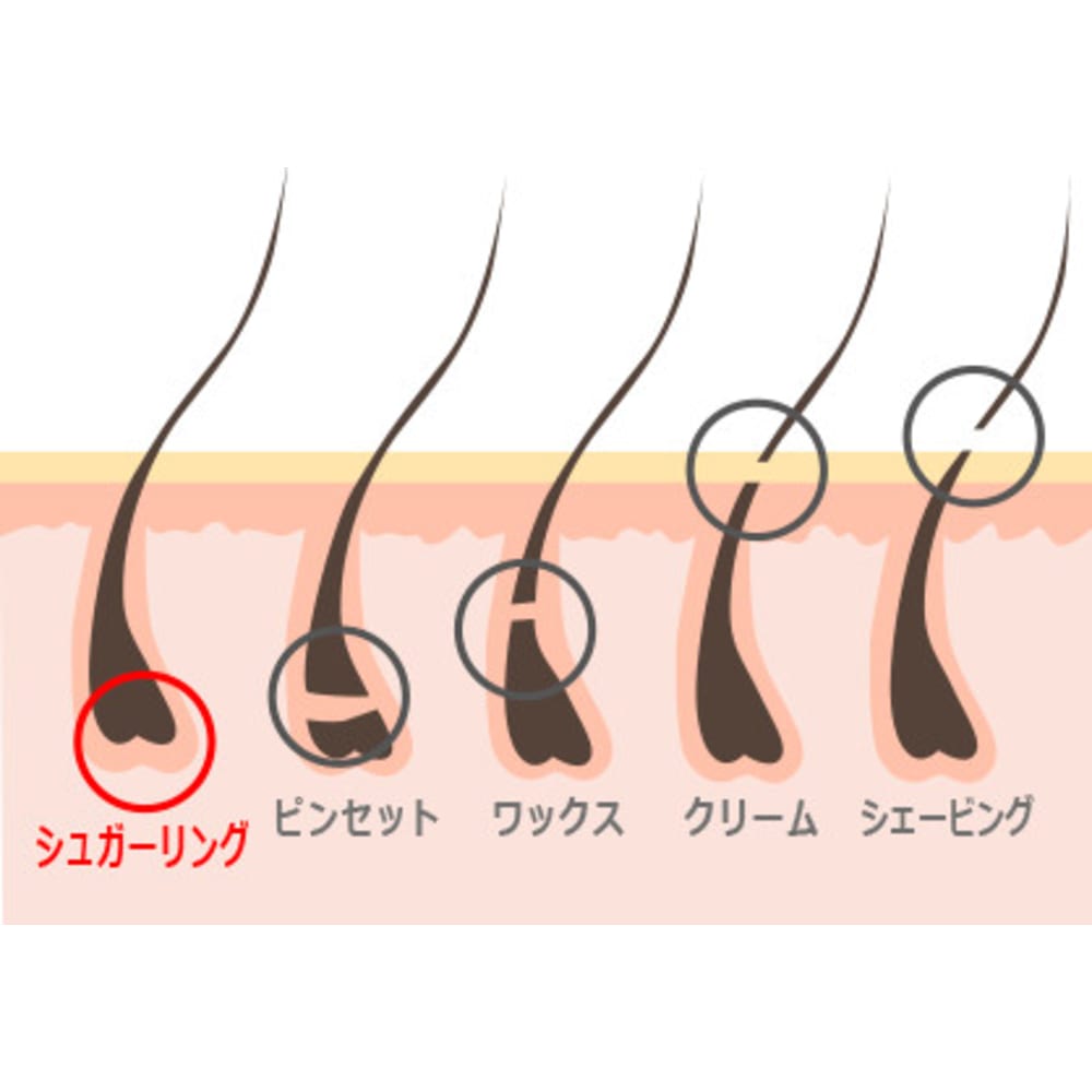 75+ ブラジリアン ワックス 短い 毛 - すべての人気の壁紙