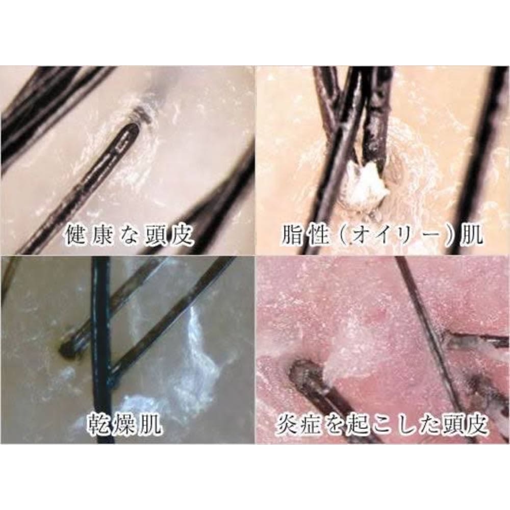 毛穴ケア 肌トラブル改善専門店 Cell セル ケアナケアハダトラブルカイゼンセンモンテンセル の予約 サロン情報 エステサロンを予約するなら楽天ビューティ