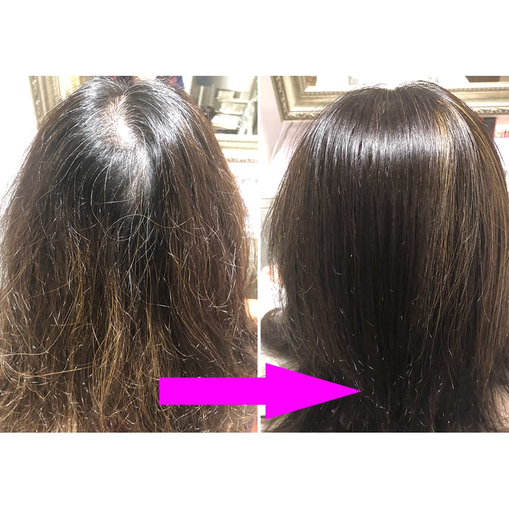 生えグセ改善 ヘアリセッター Lucy ルーシー のこだわり特集 美容院 美容室を予約するなら楽天ビューティ