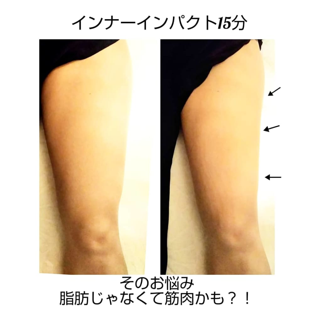 ボディ人気no 1 ハイパーナイフ インナーインパクト150分 ハイパーナイフ痩身 ブライダル専門salonvary広尾 サロンヴェアリー のこだわり特集 エステサロンを予約するなら楽天ビューティ