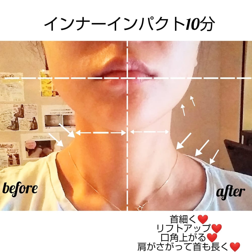 ボディ人気no 1 ハイパーナイフ インナーインパクト150分 ハイパーナイフ痩身 ブライダル専門salonvary広尾 サロンヴェアリー のこだわり特集 エステサロンを予約するなら楽天ビューティ