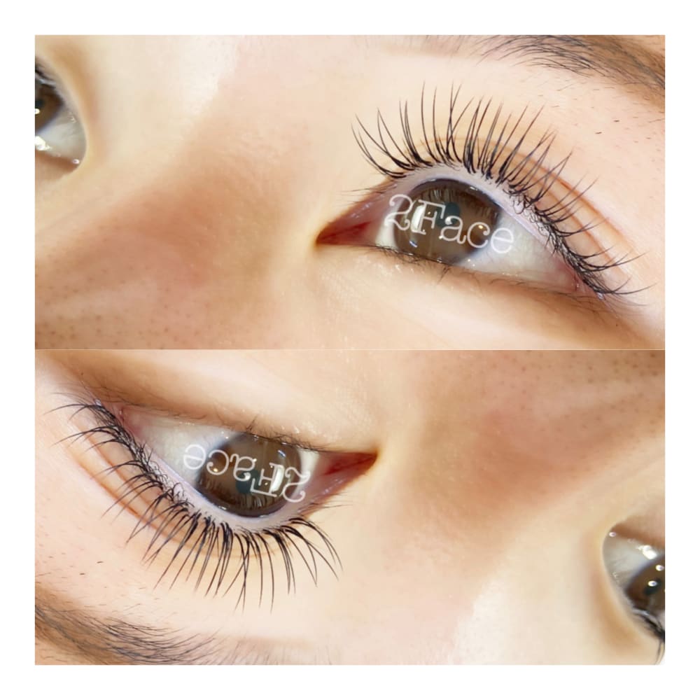 2FACE esthetic 画像1