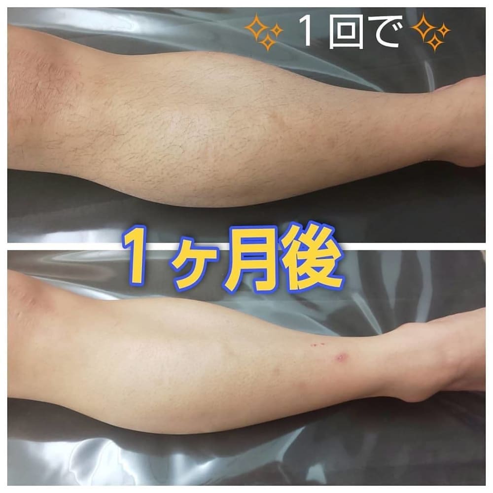 メンズビューティサロン心斎橋 Before After メンズビューティーサロン メンズビューティーサロン のこだわり特集 エステサロンを予約するなら楽天ビューティ メンズビューティサロン心斎橋 Before After メンズビューティーサロン メンズビューティーサロン のこだわり特集 エステサロンを予約するなら楽天ビューティ