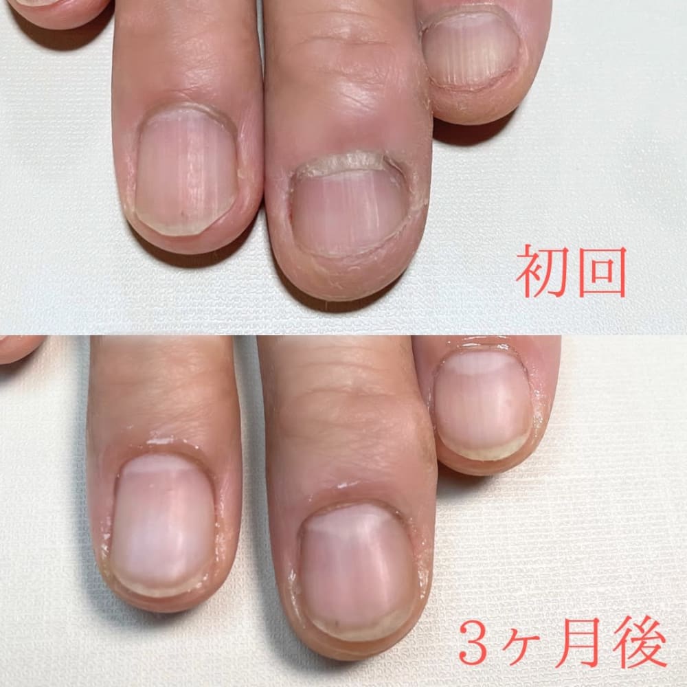 爪のコンプレックス解消 Hairstudio Level ヘアースタジオレベル のこだわり特集 ネイル まつげサロンを予約するなら楽天ビューティ