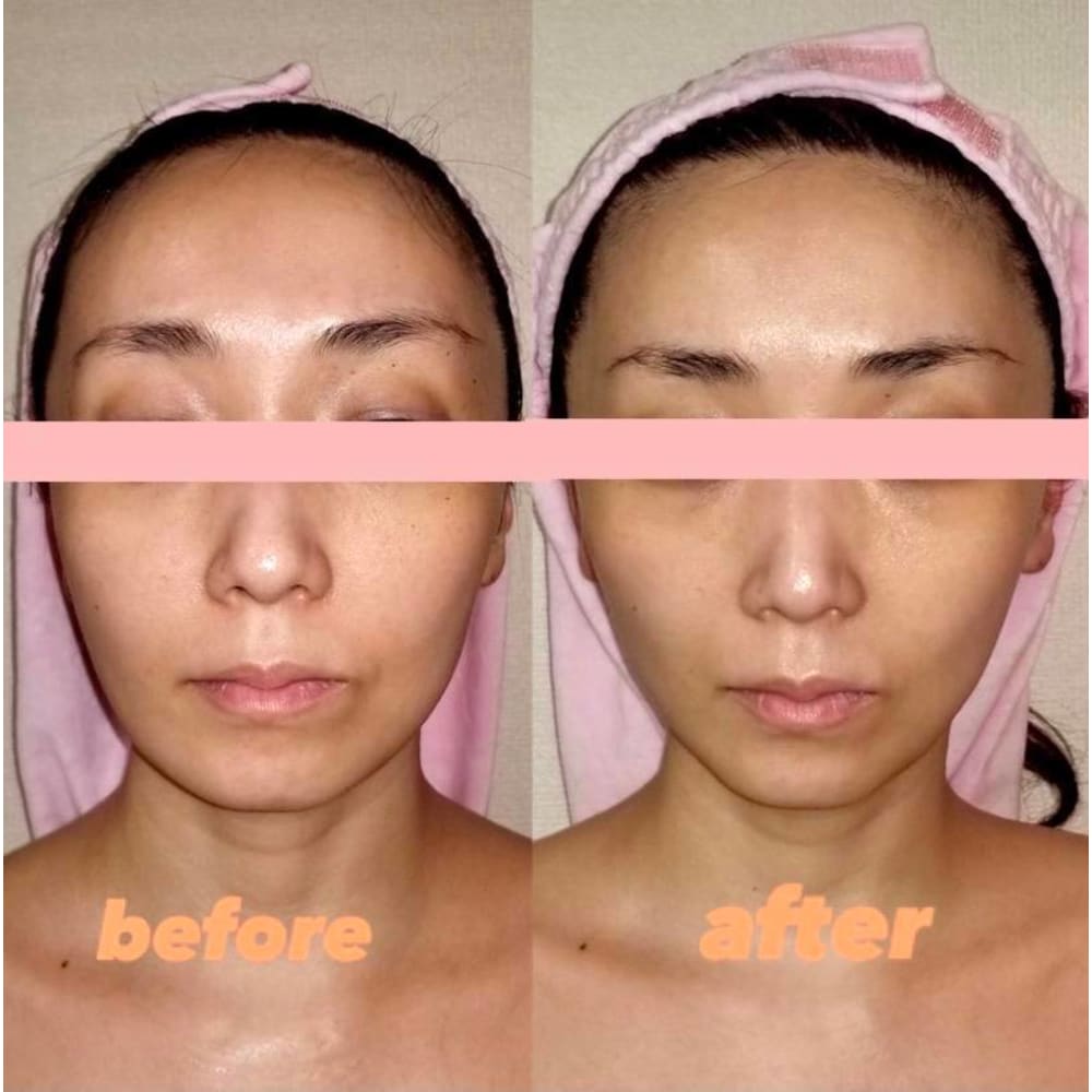 小顔 リフトアップ 美白フェイシャルエステ １２０分 初回 21 500 13 900円 新世代フェイスリフトアップ ボディ痩身専門店 ルージュ恵比寿 シンセダイフェイスリフトアップアンドボディソウシンセンモンテン ルージュエビス のこだわり特集 エステサロンを予約