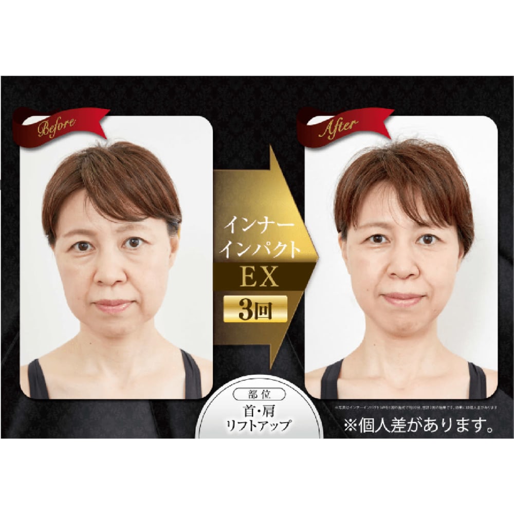 痩身から歪み対策まで美容と健康にアプローチする超短波美容機器 インナーインパクト カラダ革命salon リアンローズ京都店 カラダカクメイサロン リアンローズキョウトテン のこだわり特集 エステサロンを予約するなら楽天ビューティ
