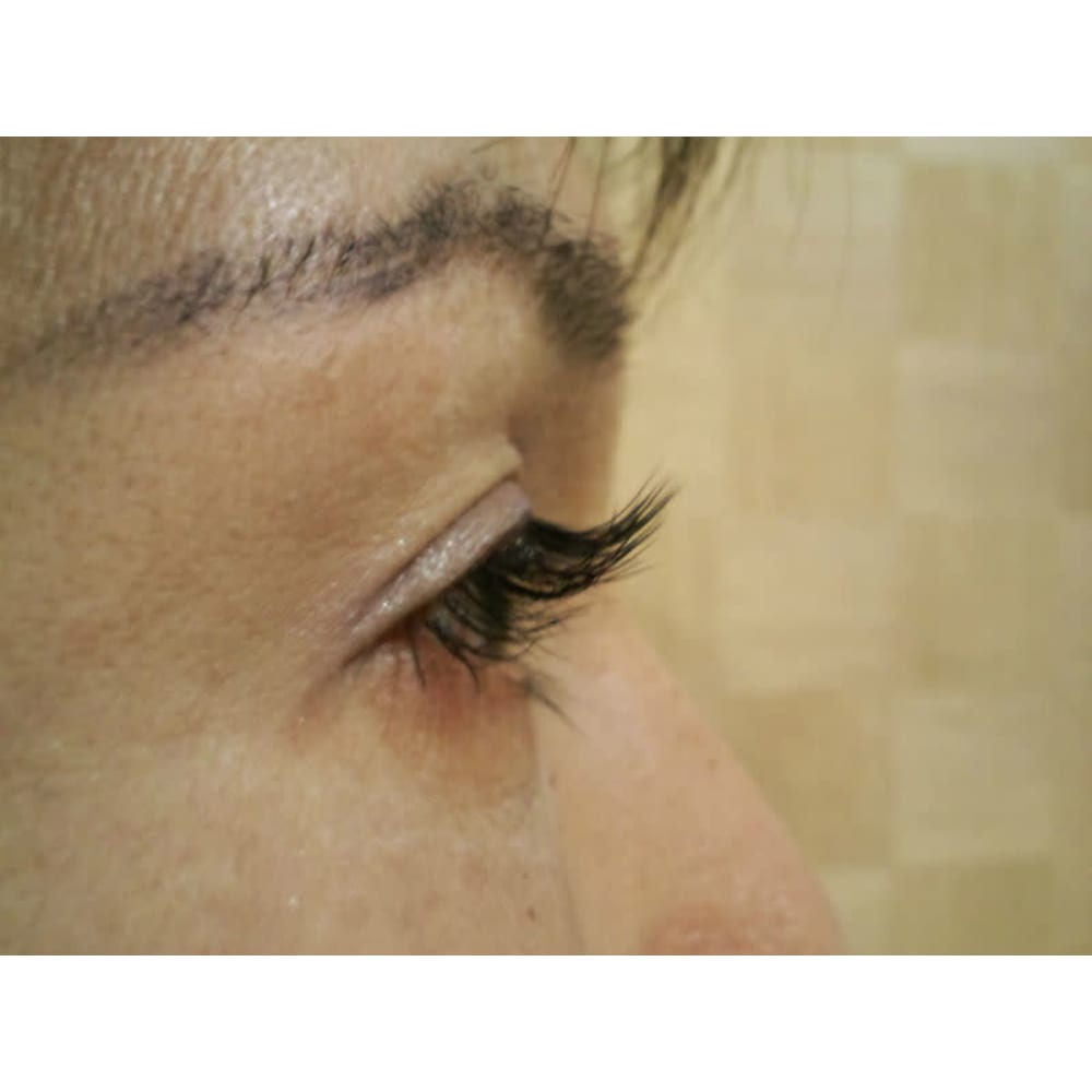 A・ビアントー 画像1