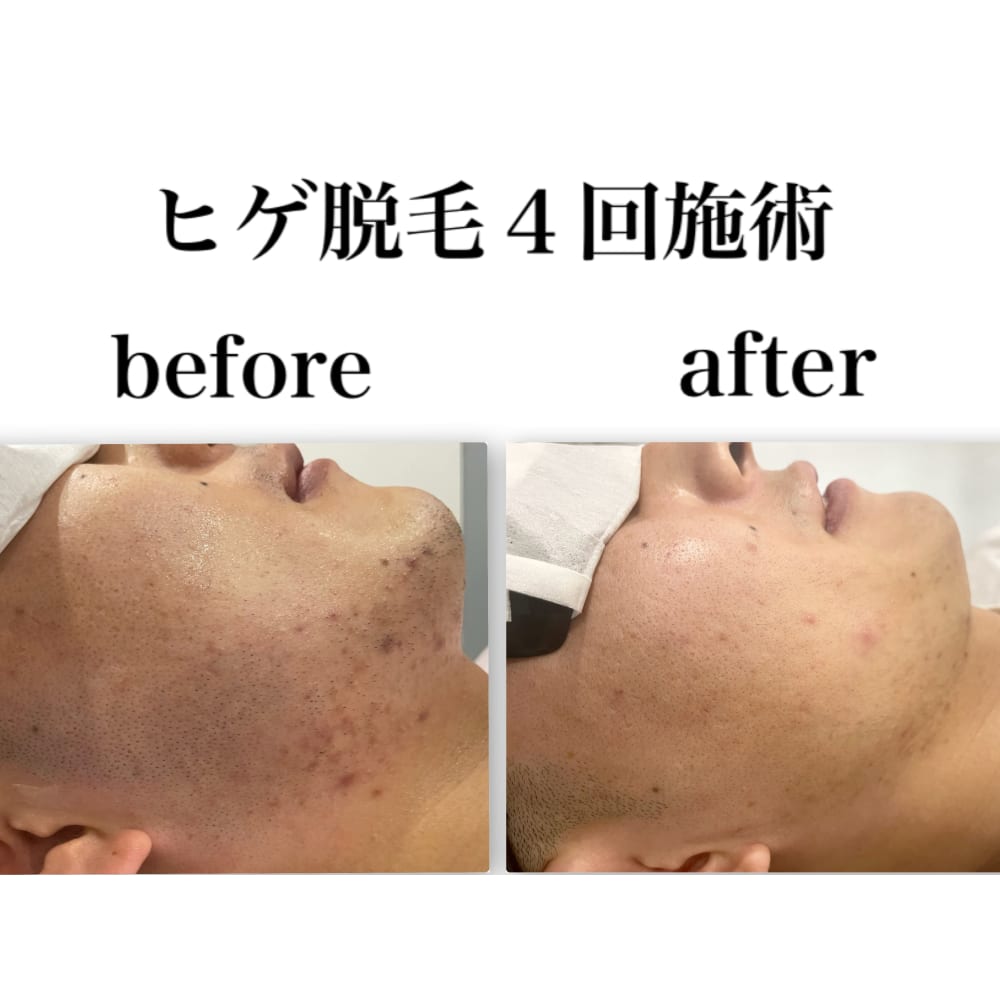 メンズ脱毛フェイシャル専門店 Joieange京橋 メンズダツモウフェイシャルセンモン ジョアアンジェキョウバシ の予約 サロン情報 エステサロンを予約するなら楽天ビューティ