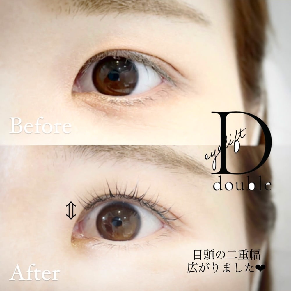 仙台で希少 Snsで話題のダブルアイリフト 認定資格者による最新の二重に近づけるまつげパーマ Otas オータス のこだわり特集 美容院 美容室を予約するなら楽天ビューティ