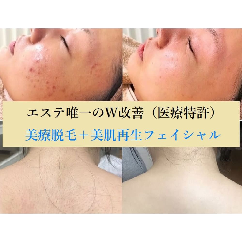 顔脱毛 Vio脱毛 小顔 毛穴ケア ナチュレ メディカ ナチュレアンドメディカ の予約 サロン情報 エステサロンを予約するなら楽天ビューティ