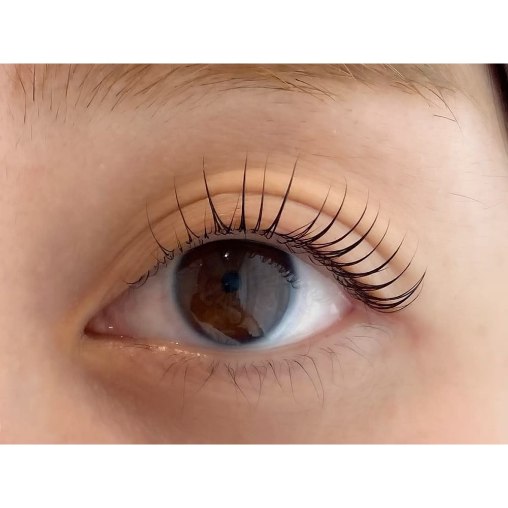 Choupinet by Arbre et chimie 画像2