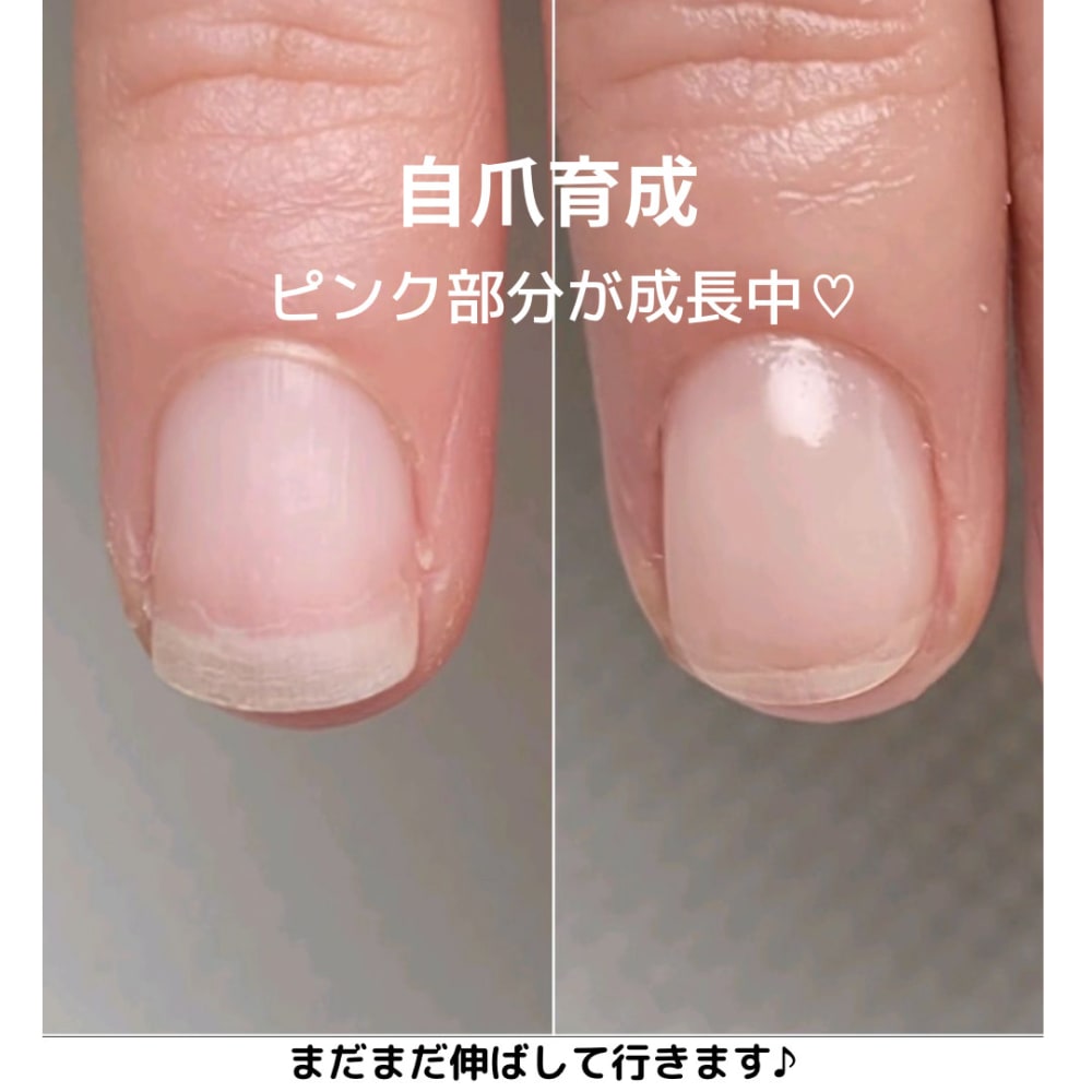 深爪 自爪育成 脱毛サロン elle&
