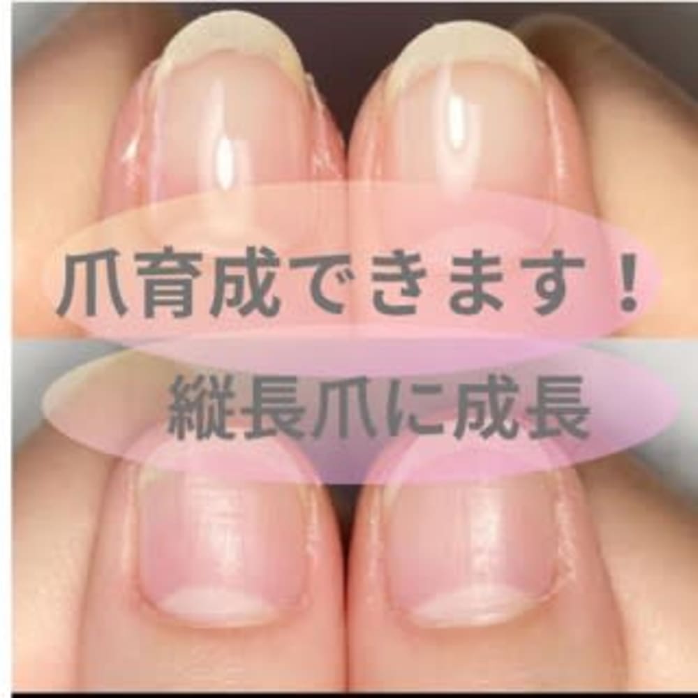 深爪 自爪育成 脱毛サロン elle& 画像
