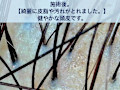 正常な美しい頭皮の写真です