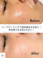 1回でお肌 白玉肌★(オハダ シラタマハダ)