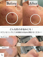 肌のお悩み 全て改善♪(ハダノオナヤミ スベテカイゼン)