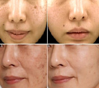 白玉フェイシャル(シラタマ)