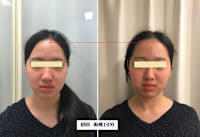 オンダリフト　ONDA(オンダ)