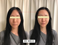 オンダリフト　ONDA(オンダ)