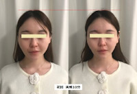 オンダリフト　ONDA(オンダ)