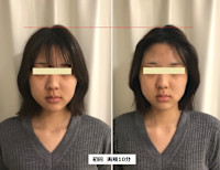 オンダリフト　ONDA(オンダ)