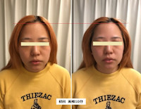 オンダリフト　ONDA(オンダ)