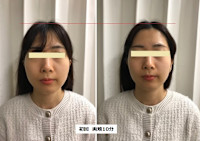 オンダリフト　ONDA(オンダ)