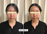 オンダリフト　ONDA(オンダ)