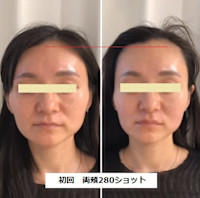 ソフウェーブ(ソフウェーブ)