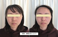 ソフウェーブ(ソフウェーブ)