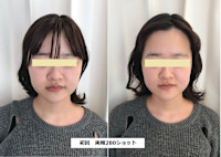 ソフウェーブ(ソフウェーブ)