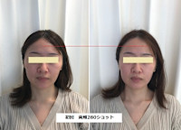 ソフウェーブ(ソフウェーブ)