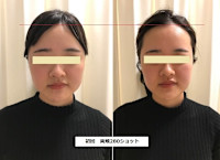 ソフウェーブ(ソフウェーブ)