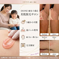 美肌脱毛専門サロン Dione 麻布十番店1(ビハダダツモウセンモンサロンディオーネ アザブジュウバンテン)