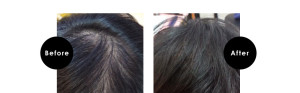 頭皮（育毛）ケア　50代女性 - hair studio 102掲載