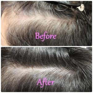 白髪の増化を抑えるあり【薬剤除去カラー】 - くせ毛専門美容室ヘアエステ ウィルミナ掲載