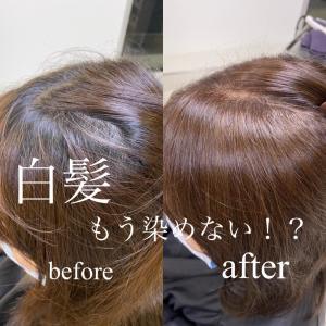 白髪染めbefore after /西原晃 - FACE。大船掲載