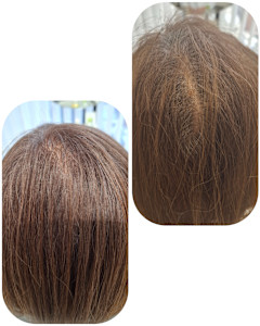 話題のトキカタ♪頭頂部編 - Hair & Spa y‐Forme Ginza掲載