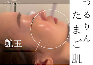 プライベートサロンチッチ