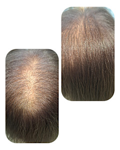 話題のトキカタ♪頭頂部編 - Hair & Spa y‐Forme Ginza掲載