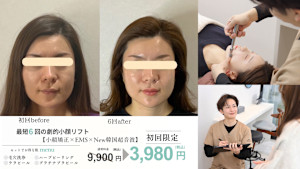 小顔・肌質改善サロンespoir ハーブピーリング/毛穴(コガオハダシツカイゼンサロンエスポワールハーブピーリングケアナ)